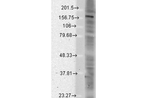 SHANK2 antibody  (AA 84-309)