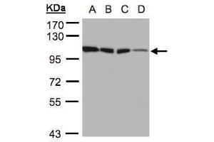 WB Image Sample(30 ug whole cell lysate) A:A431, B:H1299 C:HeLa S3, D:Hep G2 , 7. (Hexokinase 1 antibody)