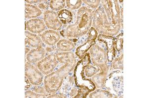Immunohistochemistry (IHC) image for anti-Glycosylphosphatidylinositol Specific phospholipase D1 (GPLD1) (AA 24-160) antibody (ABIN6141335)