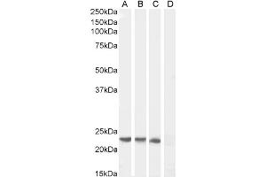 SOCS1 antibody  (C-Term)