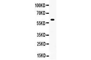 Western blot analysis of GPI expression in mouse thymus extract ( Lane 1).
