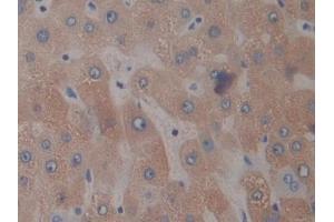 DAB staining on IHC-P; Samples: Human Liver Tissue (PTX3 antibody  (AA 183-381))