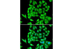 Immunofluorescence analysis of HeLa cell using NEK3 antibody. (NEK3 antibody)