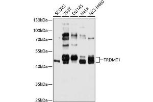 Western blot analysis of extracts of various cell lines, using TRDMT1 antibody (ABIN6131596, ABIN6149479, ABIN6149480 and ABIN6214817) at 1:1000 dilution. (Dnmt2 antibody  (AA 192-391))