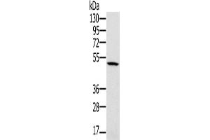 Western Blotting (WB) image for anti-Proteasome (Prosome, Macropain) 26S Subunit, ATPase, 2 (PSMC2) antibody (ABIN2423817) (PSMC2 antibody)