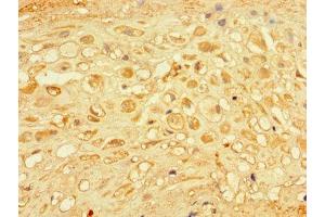 Immunohistochemistry of paraffin-embedded human placenta tissue using ABIN7166973 at dilution of 1:100 (CHM antibody  (AA 1-653))