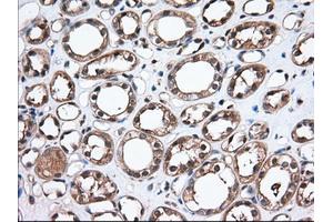 Immunohistochemical staining of paraffin-embedded Human Kidney tissue using anti-TBXAS1 mouse monoclonal antibody. (TBXAS1 antibody)