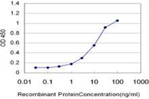 Detection limit for recombinant GST tagged DSCR1 is approximately 0. (RCAN1 antibody  (AA 1-100))