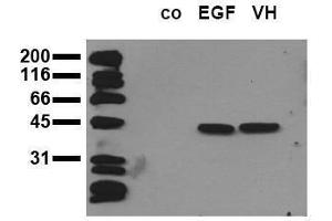 Western Blotting (WB) image for anti-Mitogen-Activated Protein Kinase 3 (MAPK3) (pThr-Glu-pTyr) antibody (ABIN126831)
