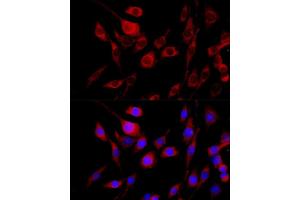 Immunofluorescence analysis of PC-12 cells using FGFR2 antibody (ABIN6130457, ABIN6140615, ABIN6140617 and ABIN6216059) at dilution of 1:100 (40x lens). (FGFR2 antibody  (AA 245-345))