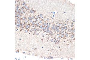 Immunohistochemistry of paraffin-embedded mouse brain using P Rabbit mAb (ABIN7269161) at dilution of 1:100 (40x lens). (PAK3 antibody)