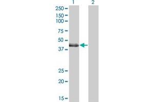 Western Blot analysis of LMCD1 expression in transfected 293T cell line by LMCD1 polyclonal antibody (A01). (LMCD1 antibody  (AA 266-364))
