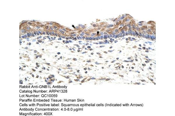 GNB1L antibody  (C-Term)
