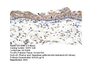 Rabbit Anti-GNB1L Antibody  Paraffin Embedded Tissue: Human Skin Cellular Data: Squamous epithelial cells Antibody Concentration: 4. (GNB1L antibody  (C-Term))