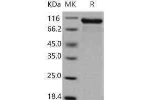 Western Blotting (WB) image for Receptor tyrosine-protein kinase erbB-2 (ErbB2/Her2) (AA 4-656) protein (His tag) (ABIN7321222) (ErbB2/Her2 Protein (AA 4-656) (His tag))
