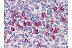 Human Spleen (formalin-fixed, paraffin-embedded) stained with CD14at 4 µg/ml followed by biotinylated anti-goat IgG secondary antibody, alkaline phosphatase-streptavidin and chromogen. (CD14 antibody)