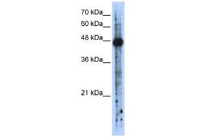 RBMS2 antibody used at 1 ug/ml to detect target protein. (RBMS2 antibody  (N-Term))