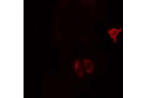 ABIN6268685 staining MCF7 cells by ICC/IF. (CD9 antibody  (Internal Region))