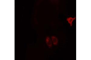 ABIN6268685 staining MCF7 cells by ICC/IF. (CD9 antibody  (Internal Region))