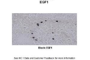 Sample Type :  Frog brain  Primary Antibody Dilution :  1:500  Secondary Antibody :  Biotinylated goat anti-rabbit  Secondary Antibody Dilution :  1:200  Color/Signal Descriptions :  Black: EGF1  Gene Name :  EGR1 a  Submitted by :  Eva Fischer, Colorado State University (EGR1 antibody  (N-Term))