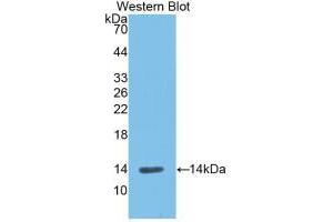 Western blot analysis of recombinant Rat REN. (Renin antibody  (AA 275-389))