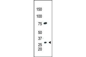 The anti-CDX1 C-term Pab (ABIN390075 and ABIN2840596) is used in Western blot to detect CDX1 in HL60 cell lysate. (CDX1 antibody  (C-Term))