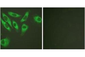 Immunofluorescence analysis of HeLa cells, using S6 Ribosomal Protein (Ab-240) Antibody. (RPS6 antibody  (AA 191-240))