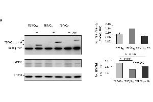 HMGB1 dysfunction in TBP/Q61~79 SH-SY5Y cells and the associated neuronal phenotype. (Histone H3.3B antibody  (full length))