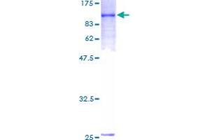 Image no. 1 for Interleukin 21 Receptor (IL21R) (AA 1-538) protein (GST tag) (ABIN1307776) (IL21 Receptor Protein (AA 1-538) (GST tag))