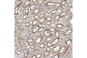 IHC analysis of ACAD9 using anti-ACAD9 antibody (ABIN7602670). (ACAD9 antibody  (AA 92-621))