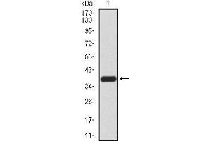 Western blot analysis using DDX20 mAb against human DDX20 (AA: 725-824) recombinant protein.