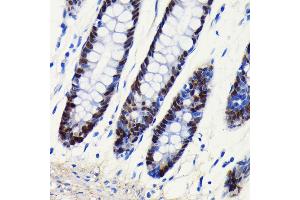 Immunohistochemistry of paraffin-embedded human colon using SOX9 antibody (ABIN7270577) at dilution of 1:100 (40x lens). (SOX9 antibody)
