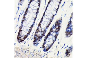 Immunohistochemistry of paraffin-embedded human colon using SOX9 antibody (ABIN7270577) at dilution of 1:100 (40x lens).
