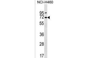 PKD2L2 Antibody (Center) (ABIN1538023 and ABIN2850127) western blot analysis in NCI- cell line lysates (35 μg/lane). (PKD2L2 antibody  (AA 193-219))