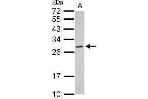WB Image Proteasome 20S alpha 6 antibody detects PSMA6 protein by Western blot analysis. (PSMA6 antibody  (Center))
