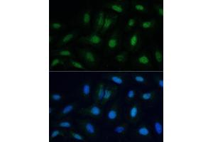 Immunofluorescence analysis of U-2 OS cells using ETS2 antibody (ABIN6133259, ABIN6140325, ABIN6140326 and ABIN6223170) at dilution of 1:100. (ETS2 antibody  (AA 160-350))