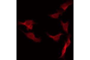 ABIN6266537 staining 293 by IF/ICC. (FASL antibody  (Internal Region))