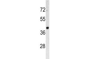 Western blot analysis of TROP2 antibody and HL-60 lysate. (TACSTD2 antibody  (AA 162-190))