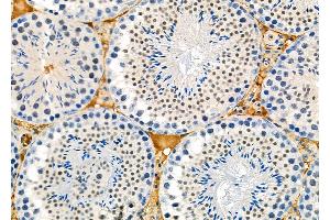 ABIN6261407 and ABIN6273114 at 1/100 staining Mouse testis tissue by IHC-P. (DYX1C1 antibody  (Internal Region))