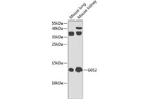 Western blot analysis of extracts of various cell lines, using G0S2 Antibody (ABIN6134775, ABIN6140856, ABIN6140858 and ABIN6225312) at 1:1000 dilution.