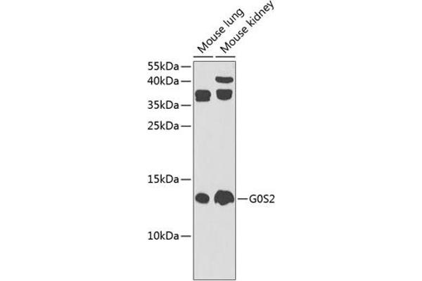 G0S2 Antikörper  (AA 1-100)
