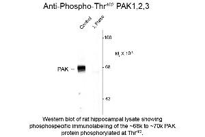 Western blot of Anti-PAK 1/2/3 pT402 (Rabbit) Antibody - 612-401-E05 Western Blot of Rabbit anti-PAK 1/2/3 pT402 antibody. (PAK1/2/3 antibody  (pThr402))