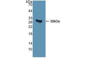 Detection of Recombinant QDPR, Human using Polyclonal Antibody to Quinoid Dihydropteridine Reductase (QDPR)