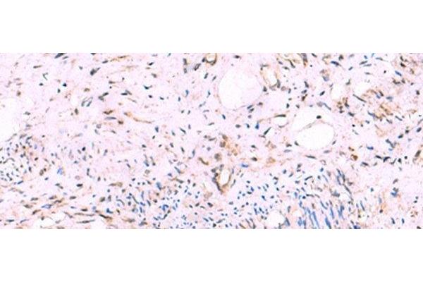 KATNAL1 antibody
