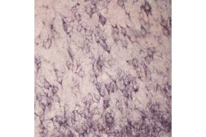 IHC on rat brain using Rabbit antibody to extracellular, N-terminal part of Sortilin (Neurotensin receptor 3, NTR3, Sort1): IgG  at a concentration of 10 µg/ml. (Sortilin 1 antibody)