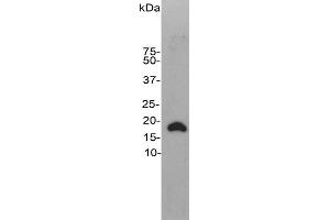 Western blot of rat brain homogenate stained with CPCA-VLP-1. (VSNL1 antibody)