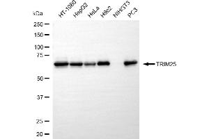 Western blotting analysis using TRIM25 antibody (ABIN7800630).