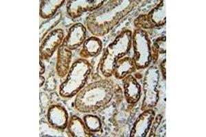 Immunohistochemistry analysis in formalin fixed and paraffin embedded human kidney tissue reacted with NDUFC2 Antibody (C-term) followed which was peroxidase conjugated to the secondary antibody and followed by DAB staining. (NDUFC2 antibody  (C-Term))