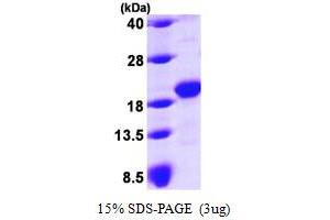 SDS-PAGE (SDS) image for GLI Pathogenesis-Related 2 (GLIPR2) (AA 1-154) protein (His tag) (ABIN667194)