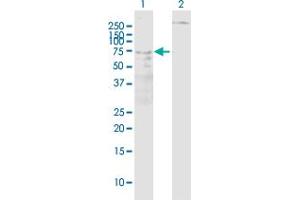 Western Blot analysis of ALOX5 expression in transfected 293T cell line ( H00000240-T01 ) by ALOX5 MaxPab polyclonal antibody. (ALOX5 antibody  (AA 1-674))